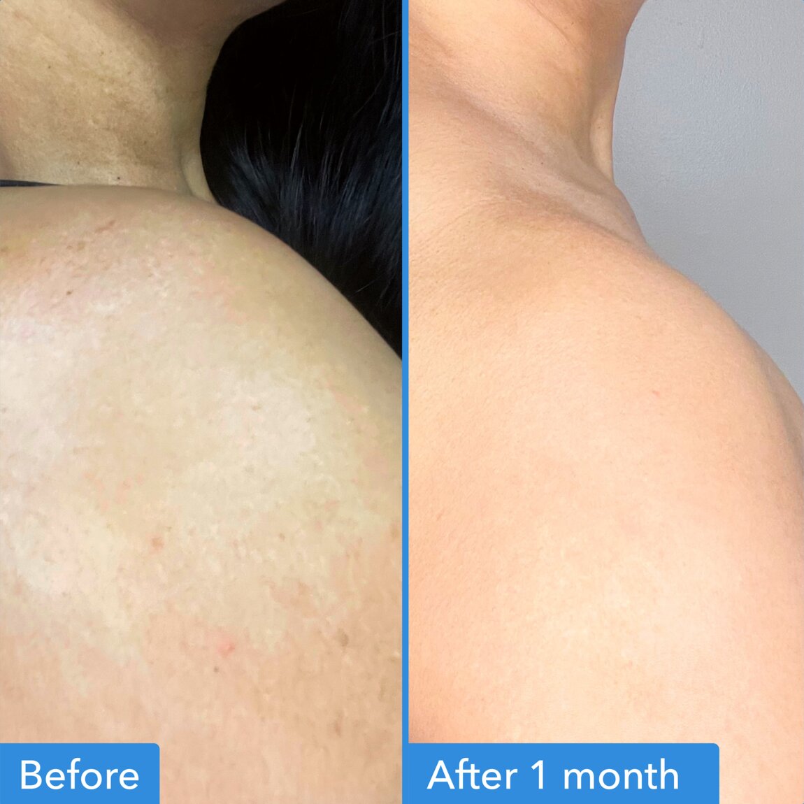 discoloration-correcting-body-treatment-g6 zb_p.jpg